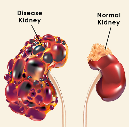  Best Doctor for Kidney Disease in Panchkula