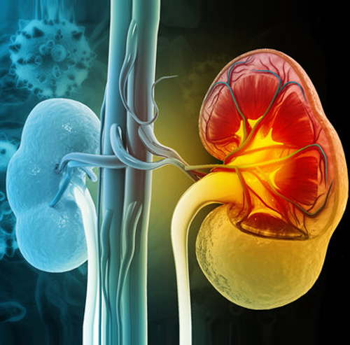 Best Kidney Specialist in Chandigarh