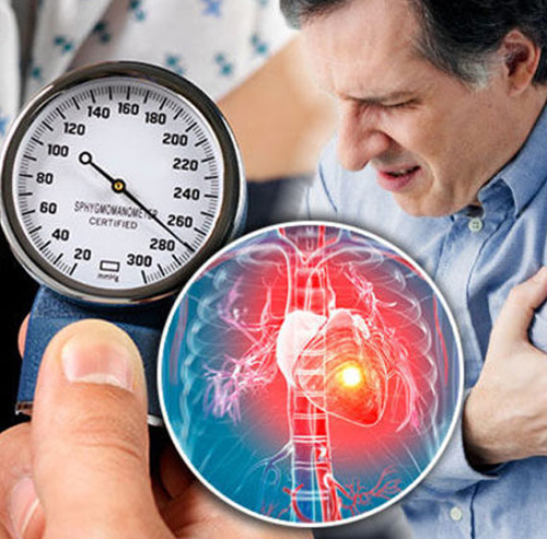 Best Doctor for Hypertension – Dr. Shilpa Bansal