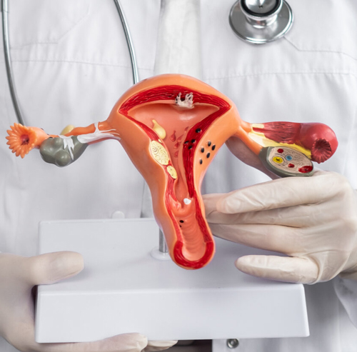 Uterine Cervical Cancer Treatment in Chandigarh by Dr. Shivam Gaba 