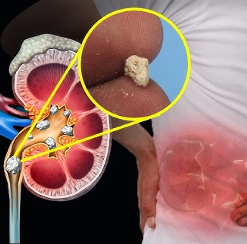 Best Doctor for Kidney Transplant – Dr. Shilpa Bansal