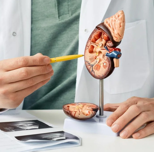 Kidney Doctor of Zirakpur