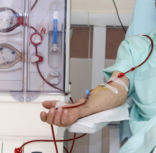 Dialysis Demystified: Hemodialysis, Peritoneal Dialysis & CRRT