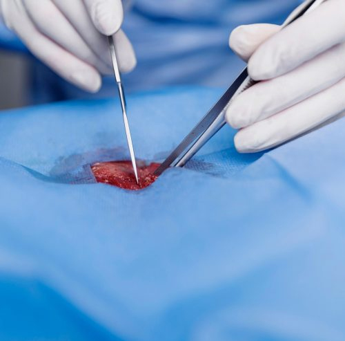 Kidney Biopsy: Why It’s Done & What Patients Should Know
