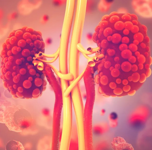 Polycystic Kidney Disease (PKD): Genetic Risk, Management & Lifestyle