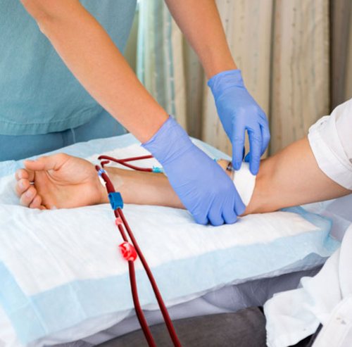 Dialysis Explained: How It Works and What Patients Can Expect