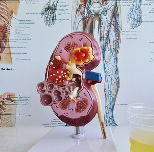 Electrolyte Imbalances & Kidney Function: What You Need to Know